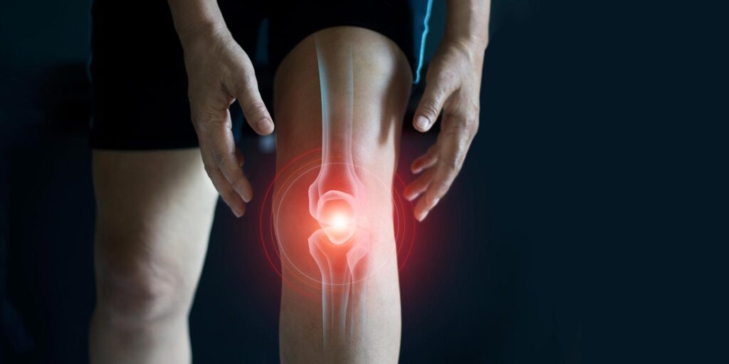 The Growing Popularity of Regenerative Orthopedics for Knee Injuries