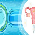 Timing and Preparation for Successful Insemination Cycles