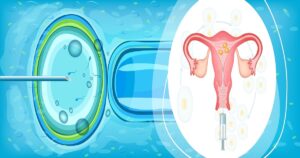 Timing and Preparation for Successful Insemination Cycles